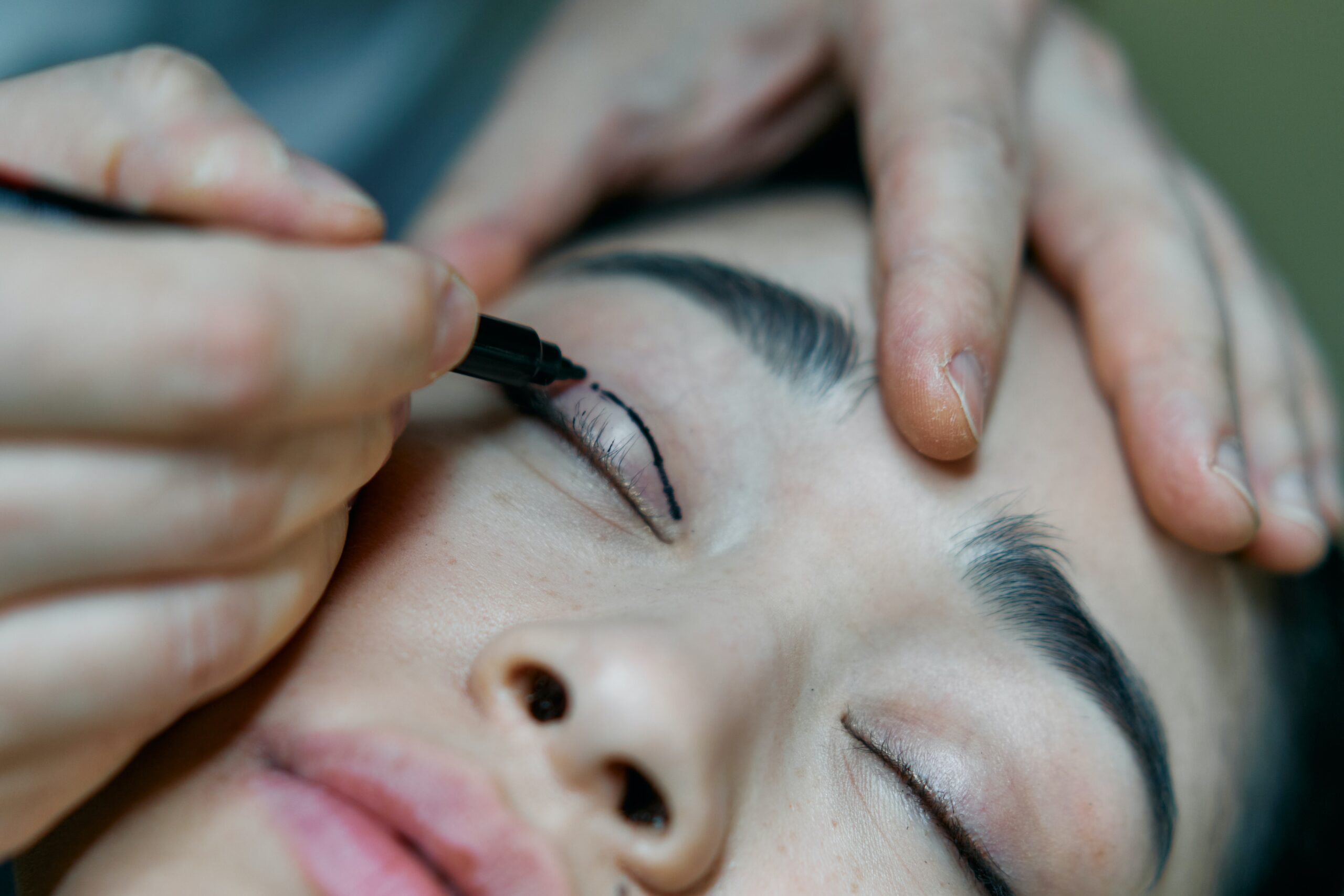 How to get insurance to pay for eyelid surgery?